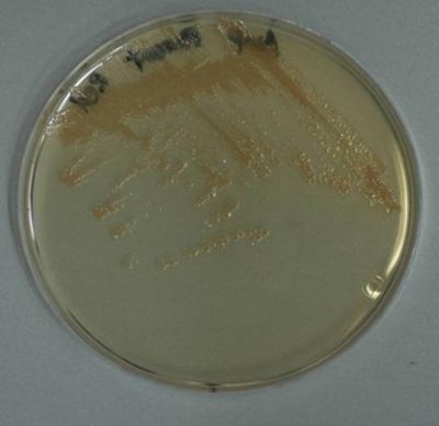 E.coli MG1655 transformed with K274110 and grown on agar plate overnight.