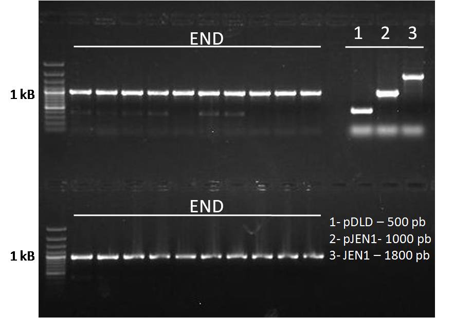 20090828 iGEM Yeast PCR END Kl.JPG