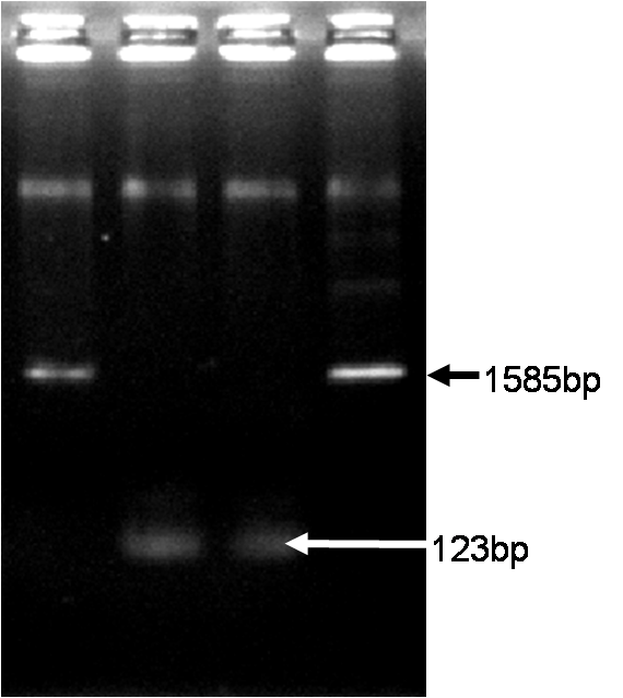 Kyoto PCR 0903.png