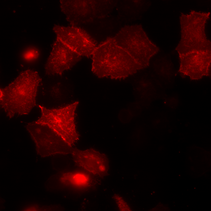 HeLa cells transfected with p5_mCHerry_PM. Imaged 24 h after transfection