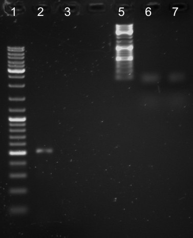 2009.05.12 - PCR pho i mgtc opisany.jpg