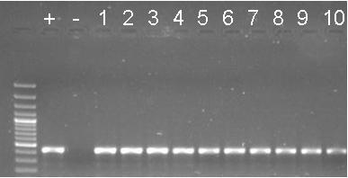 PCR de colonia.JPG