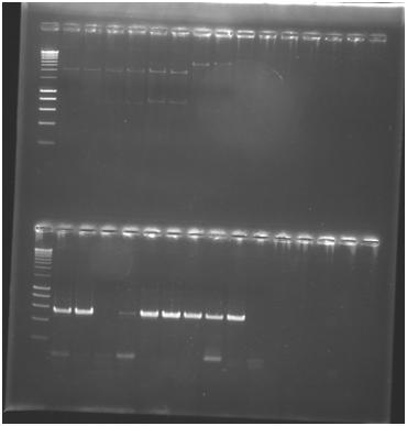 les puits du dessus  : Promoteur1, promoteur2, RBS+RFP1, RBS+RFP2, promoteur+RBS1, promoteur+RBS2, terminateur1, terminateur2.les puits du dessus : les résultats des migations des PCR