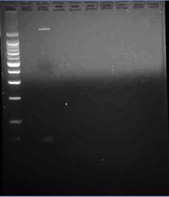 Illinois- Gel 2 of PCR of pJU-334.jpg