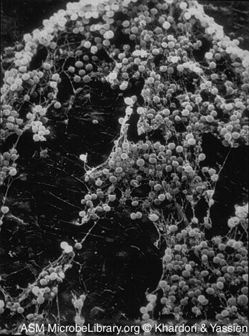 Staphylococcus epidermidis biofilm.jpg